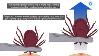 Borreliosis, Lyme disease, tick bite