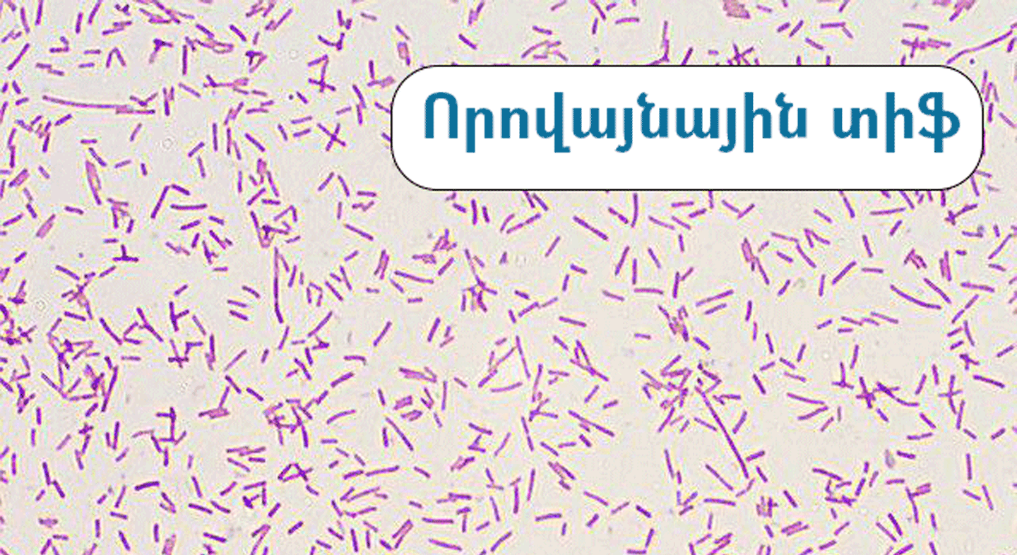 ԻՀԱԿ-ը հաջողությամբ ժամանակին արձագանքել է որովայնային տիֆի՝ Հայաստան բերված դեպքին