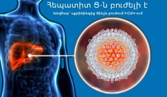 Hepatitis C: Getting tested on time can save your health